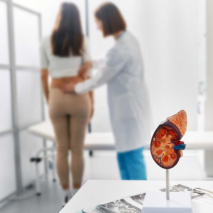 Kidney Stone Treatment in Cypress Texas